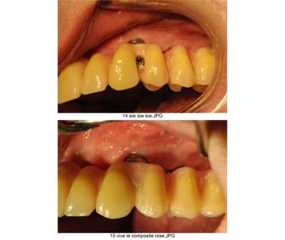 Planche contact 007 a20acw - Eugenol