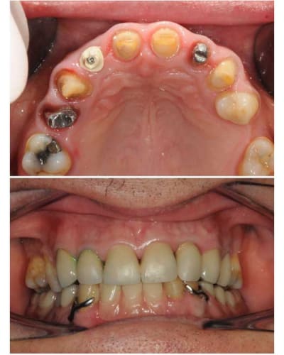 Planche contact 017 copie gtnmpw - Eugenol
