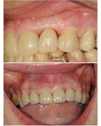 Planche contact 019 copie ketwbz - Eugenol