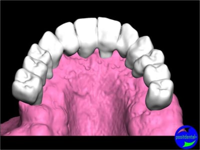 Positdental 012 uwwuu4 - Eugenol