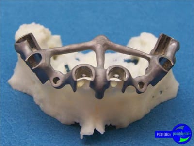 Positguide 1 drz5ub - Eugenol