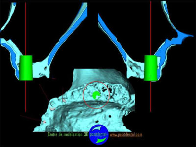 Positguide 5 q15rsw - Eugenol