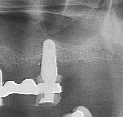 Positguide 7 kw9eyl - Eugenol