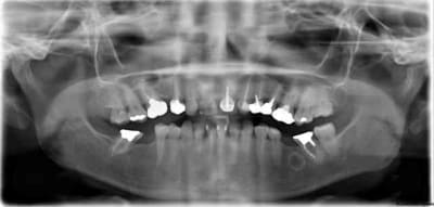 Pour jeff cjc9zs - Eugenol