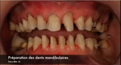 Prep dentaires iytxhx - Eugenol