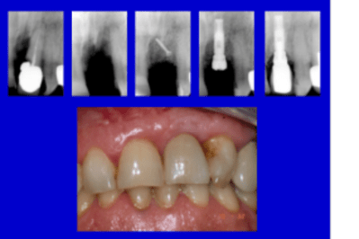 Projet1 jw9v9m - Eugenol