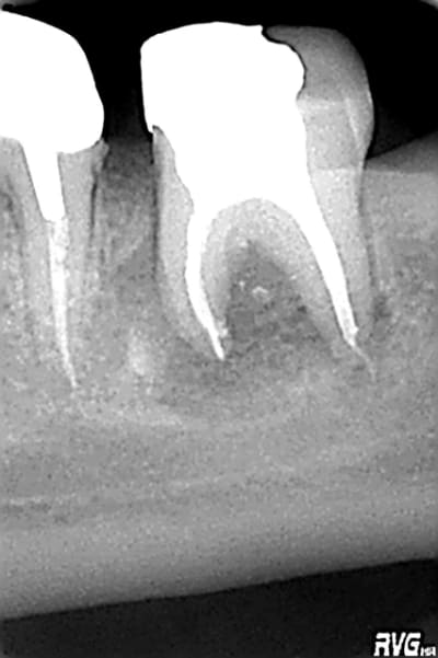 R2 fev2008 dgvymt - Eugenol