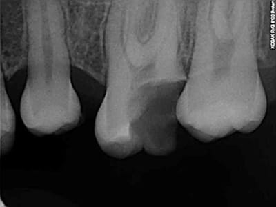 R2 a1vuvg - Eugenol