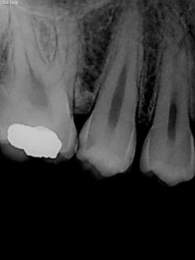 R2 hmpmrp - Eugenol