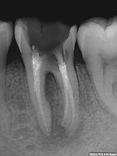 R2 irvuzk - Eugenol