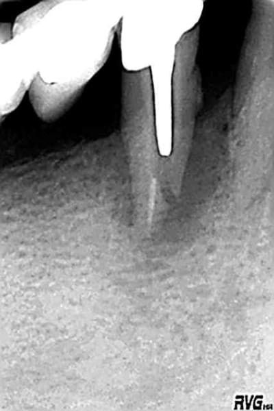 R31 pztes0 - Eugenol