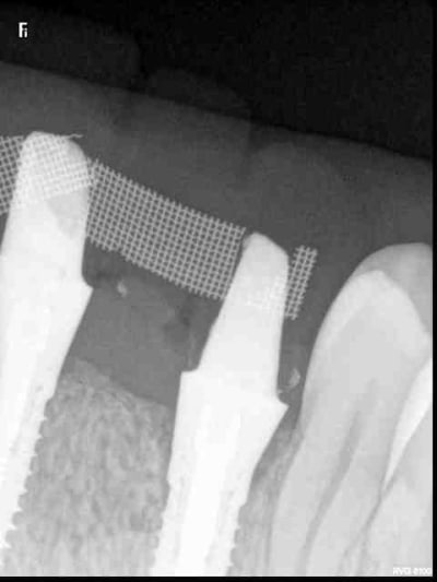 R34 lopehf - Eugenol