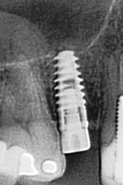 Radio xprt84 - Eugenol