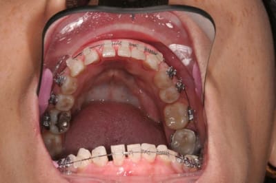 Recentrage 1 ey5h9e - Eugenol