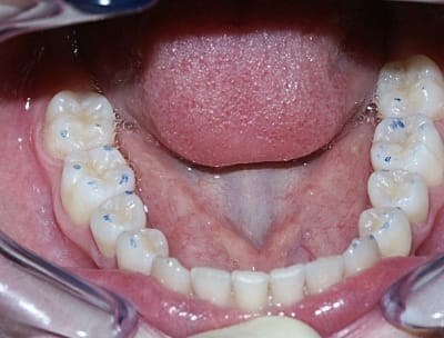 Rim1 n9brt8 - Eugenol