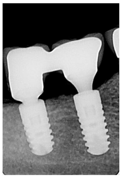 Radio r326of - Eugenol