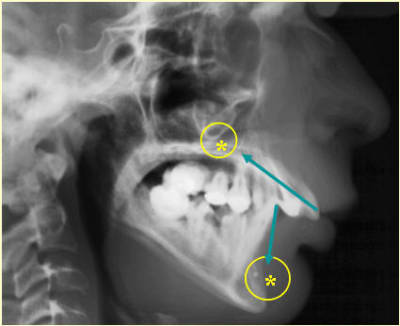 Radiotherapie sol2 vlsefi - Eugenol