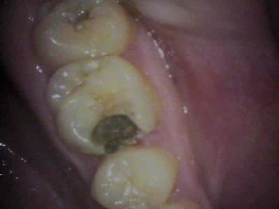 S1 bd9wb5 - Eugenol