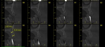 Scan3 ldab2d - Eugenol