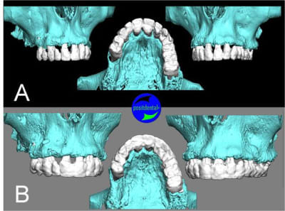 Scanner   cone bean p9qopq - Eugenol