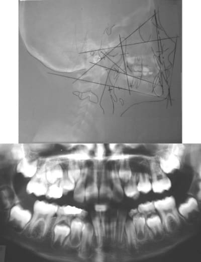 Sans titre 1 qpy6nl - Eugenol