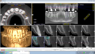 Sans titre btt2qw - Eugenol