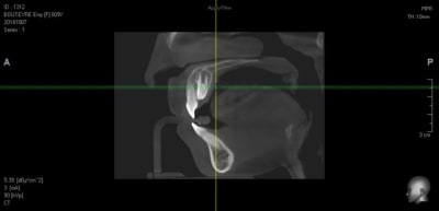 Sans titre uusjqu - Eugenol