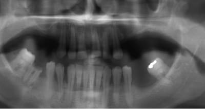 Sans titre zpqpm1 - Eugenol