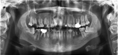 Screenshot004 mos1kw - Eugenol