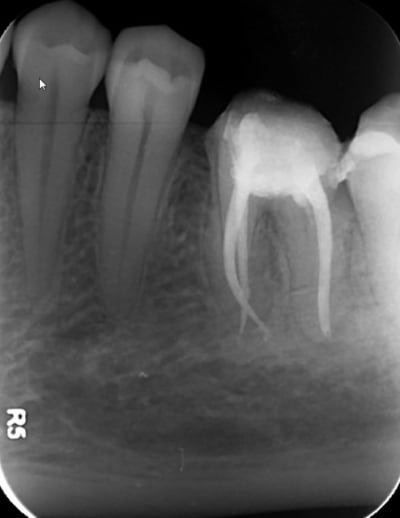 Screenshot120 xni2b3 - Eugenol