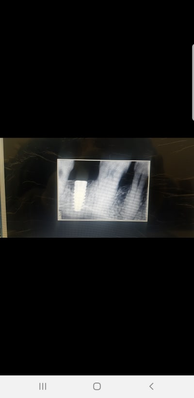 Screenshot 20200820 190633 messenger jsghah - Eugenol