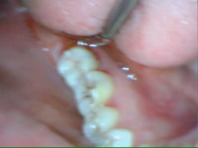 Stillcap0018 qgfjjd - Eugenol