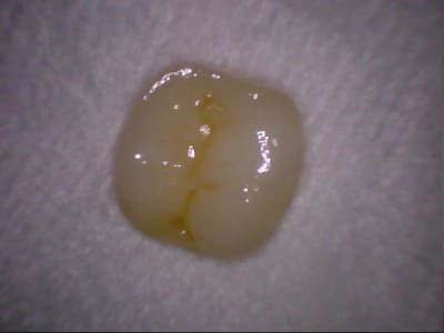 Stillcap0028 q8ooqh - Eugenol