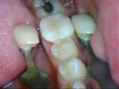 Stillcap0039 uby5tg - Eugenol