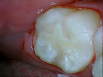 Stillcap0048 z4sdxd - Eugenol