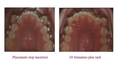 Stops 1 xjqhds - Eugenol