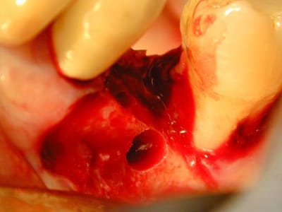 Summerstime2 nrkntd - Eugenol