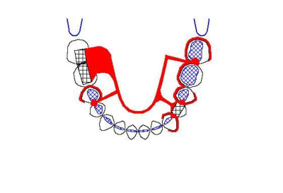 Tam 2 fk6au5 - Eugenol