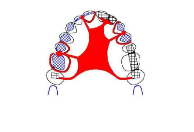 Tam 3 gjqep2 - Eugenol