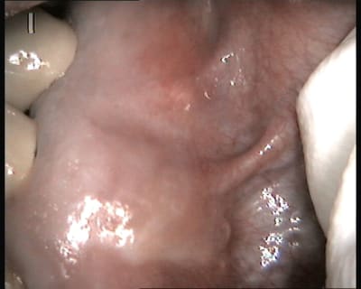 Unknown v 2013 07 18 17 04 23 3 idnlpv - Eugenol