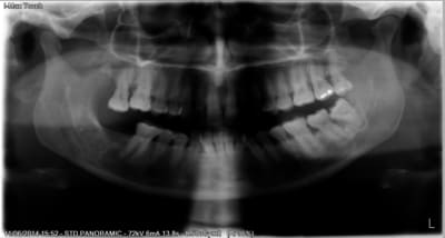 Unknown x 2014 06 11 15 52 48 4 kggiyn - Eugenol