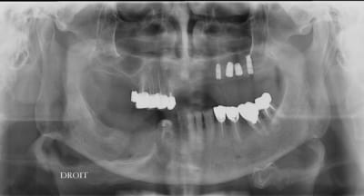 Va he15.07 - Eugenol
