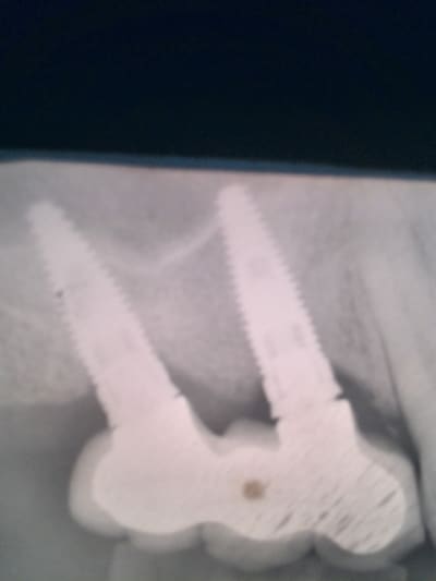 Vp5 p31u5z - Eugenol