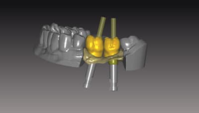 Vuev vptbye - Eugenol