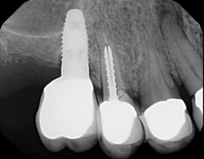 X5064906 zelemo - Eugenol