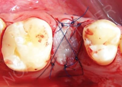 Zvi teknik w7ylzu - Eugenol