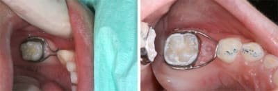  espace 1 fyho4d - Eugenol