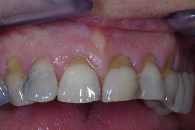  igp0153 qezhwp - Eugenol