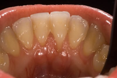  mg 0038 rltudx - Eugenol