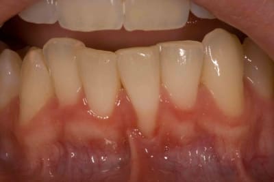  mg 0069 itg0ce - Eugenol